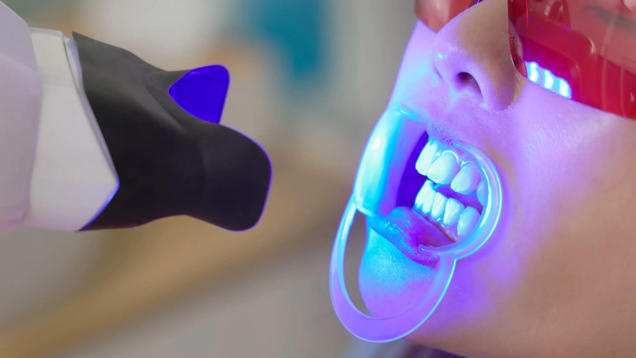 Investigation Reveals Shocking Illegal Teeth-Whitening Practices